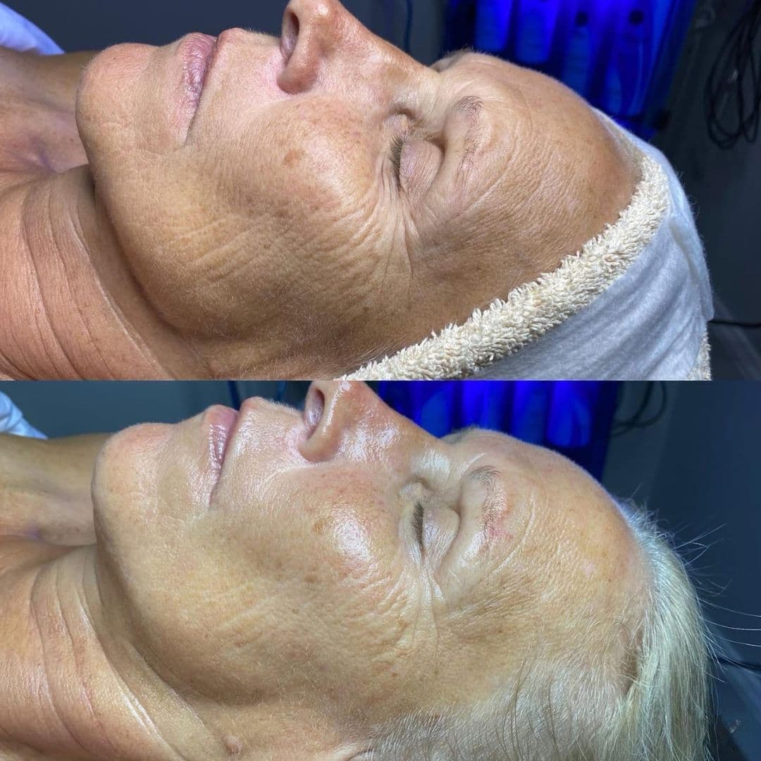 Relaxing facial spa treatment in a luxury setting