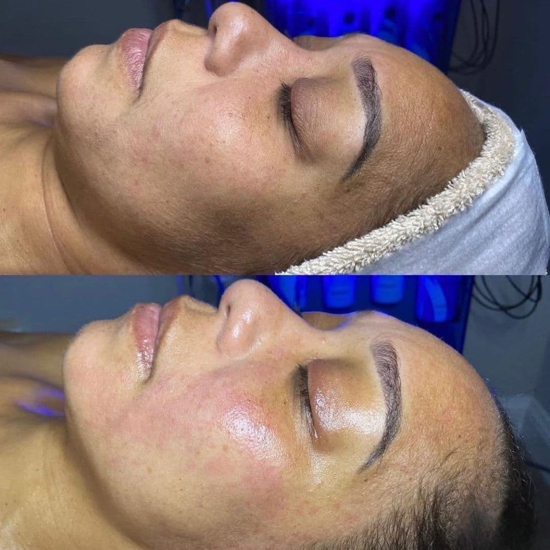 Hydrating facial skincare treatment at Shear Artistry
