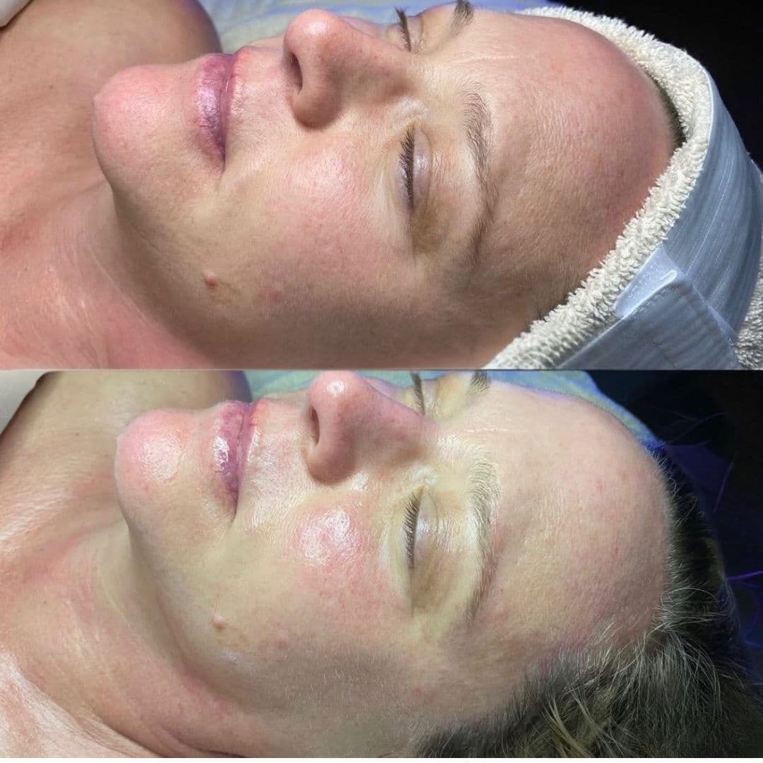 Custom facial service for healthy, radiant skin