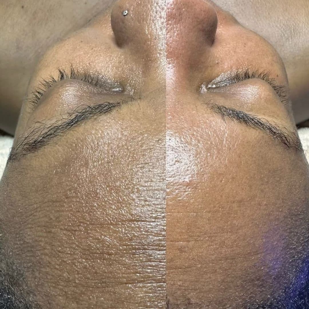 Soothing facial massage and skincare therapy